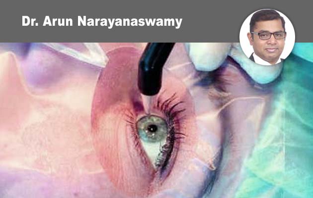 lmaging Modalities in Glaucoma: Interpretation and Clinical Application in Management