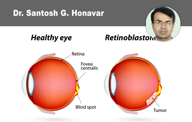 lntraocular Tumors - Mind the Mimic, Recognize the Real