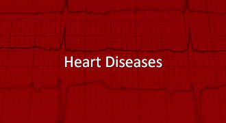 Treatment of Chronic Stable Angina